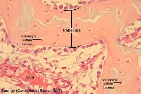 <ul><li><p>trabeculae </p></li><li><p>osteocyte</p></li><li><p>lacuna</p></li></ul><p></p>