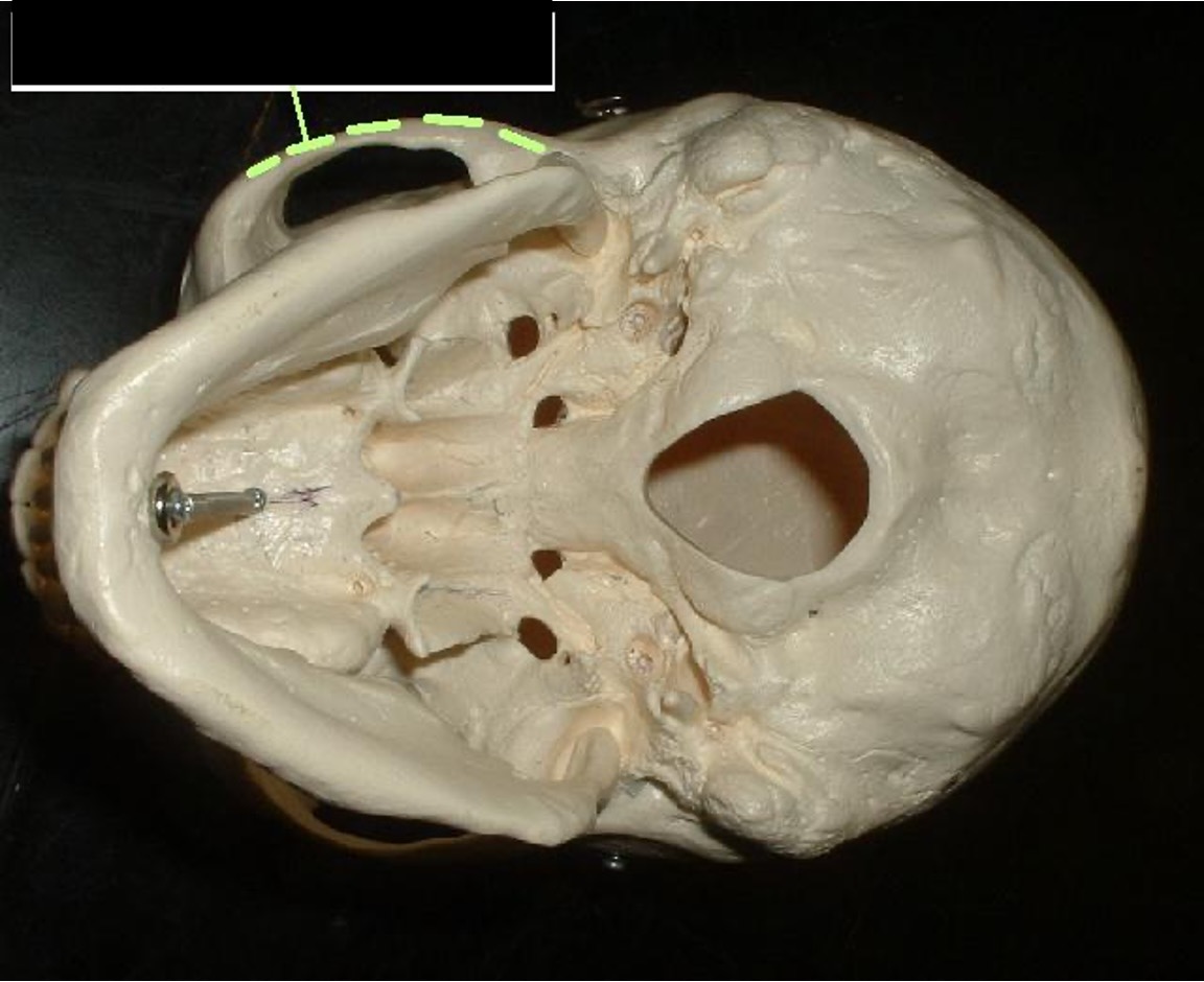 <p>It looks like a handle off of the side of the head; it includes temporal bone, zygomatic process, and maxilla; it sticks out.</p>