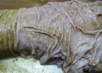 <p><span><strong>Ostertagiosis or Teladorsagiosis</strong></span></p>