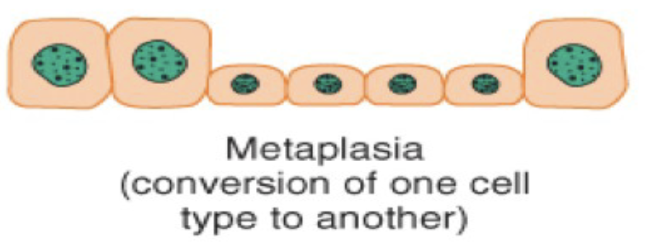 <p>Metaplasia is a cellular adaption with the ____ of one ____ ____ to another.</p>