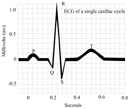 QRS represents