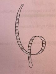 <p>What metacestode form is this? It is a cysticercus that has already begun to elongate and segment while in the IH</p>