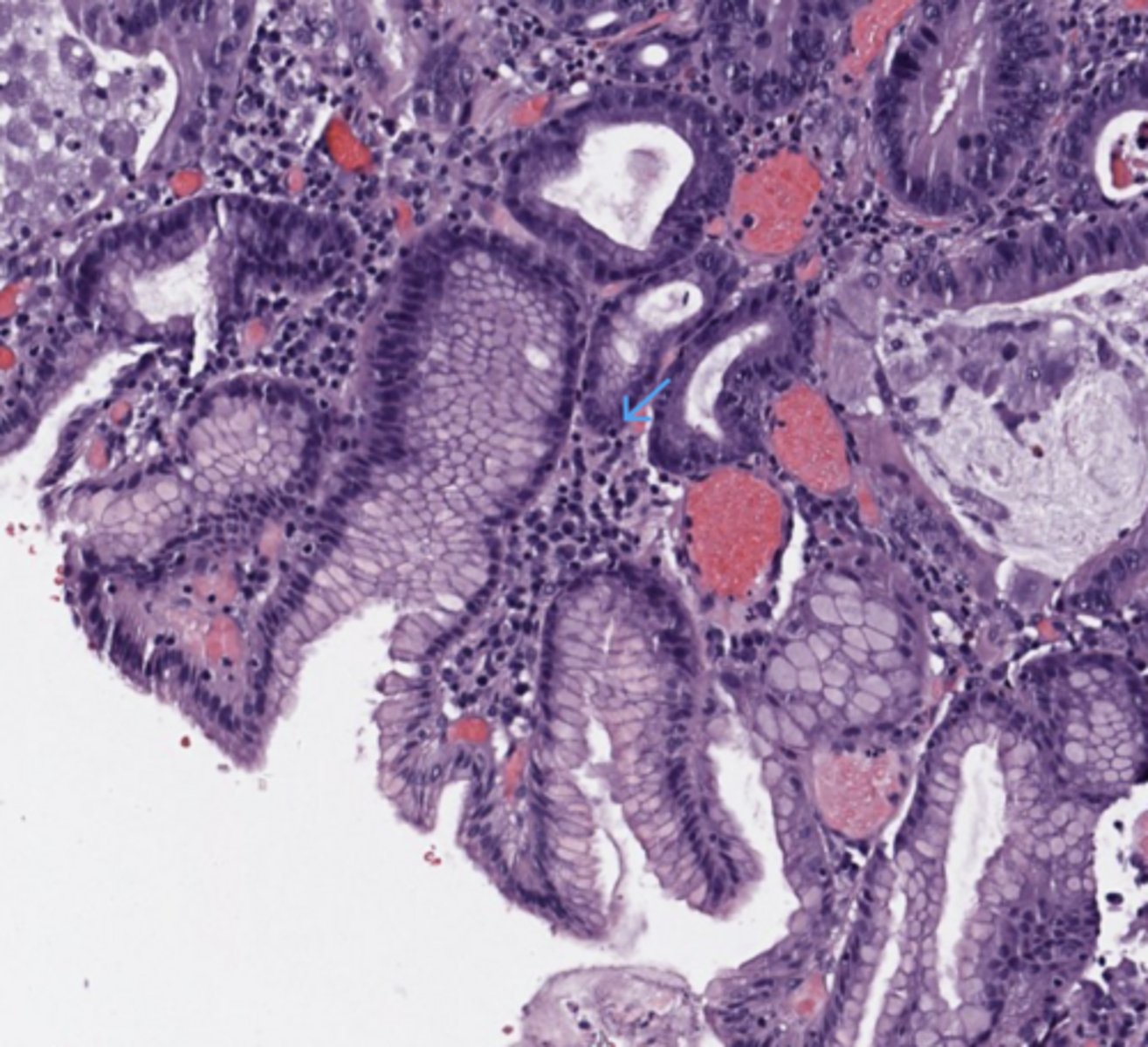 <p>Stomach</p>