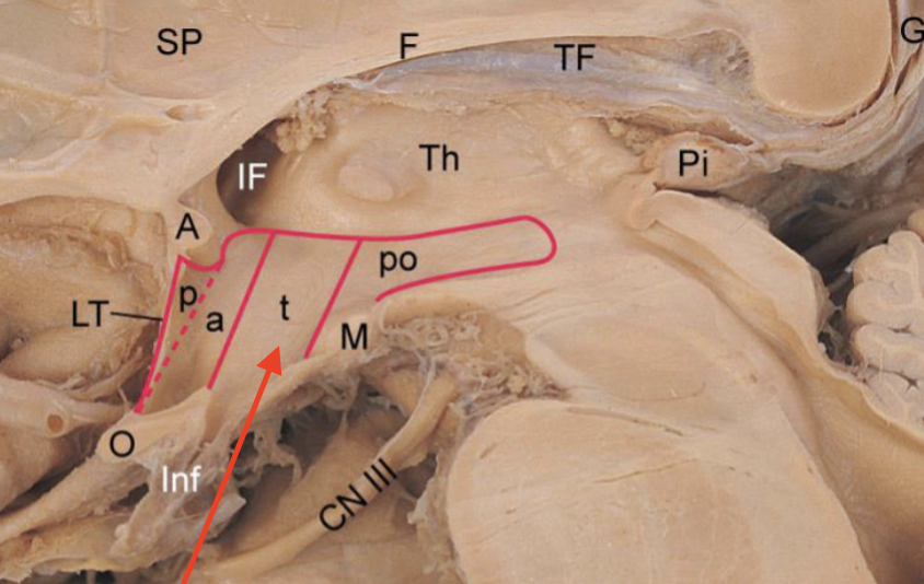 <p>region most directly superior to infindibulum</p>