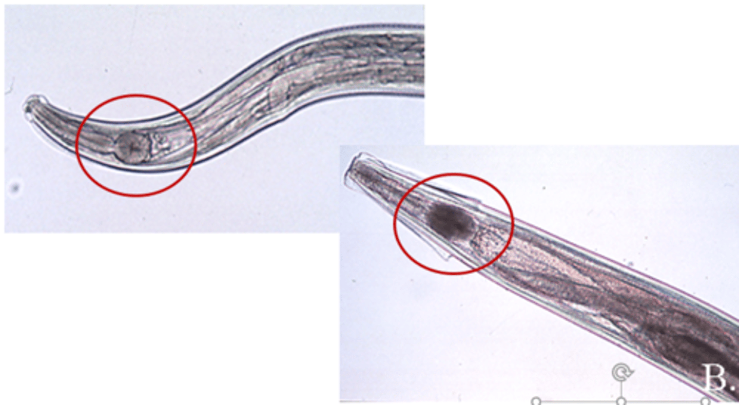 <p>What parasite is pictured above? Below ("B") ?</p>