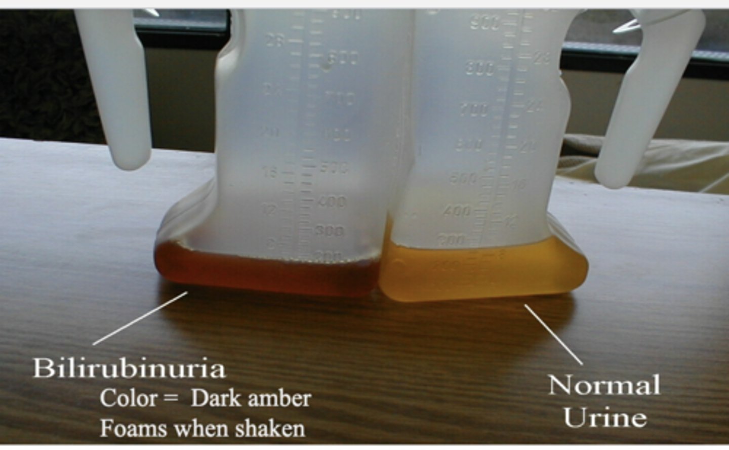 <p>-normally no bilirubin</p><p>-elevated levels of urine found WHEN BILE DUCTS BLOCKED</p>