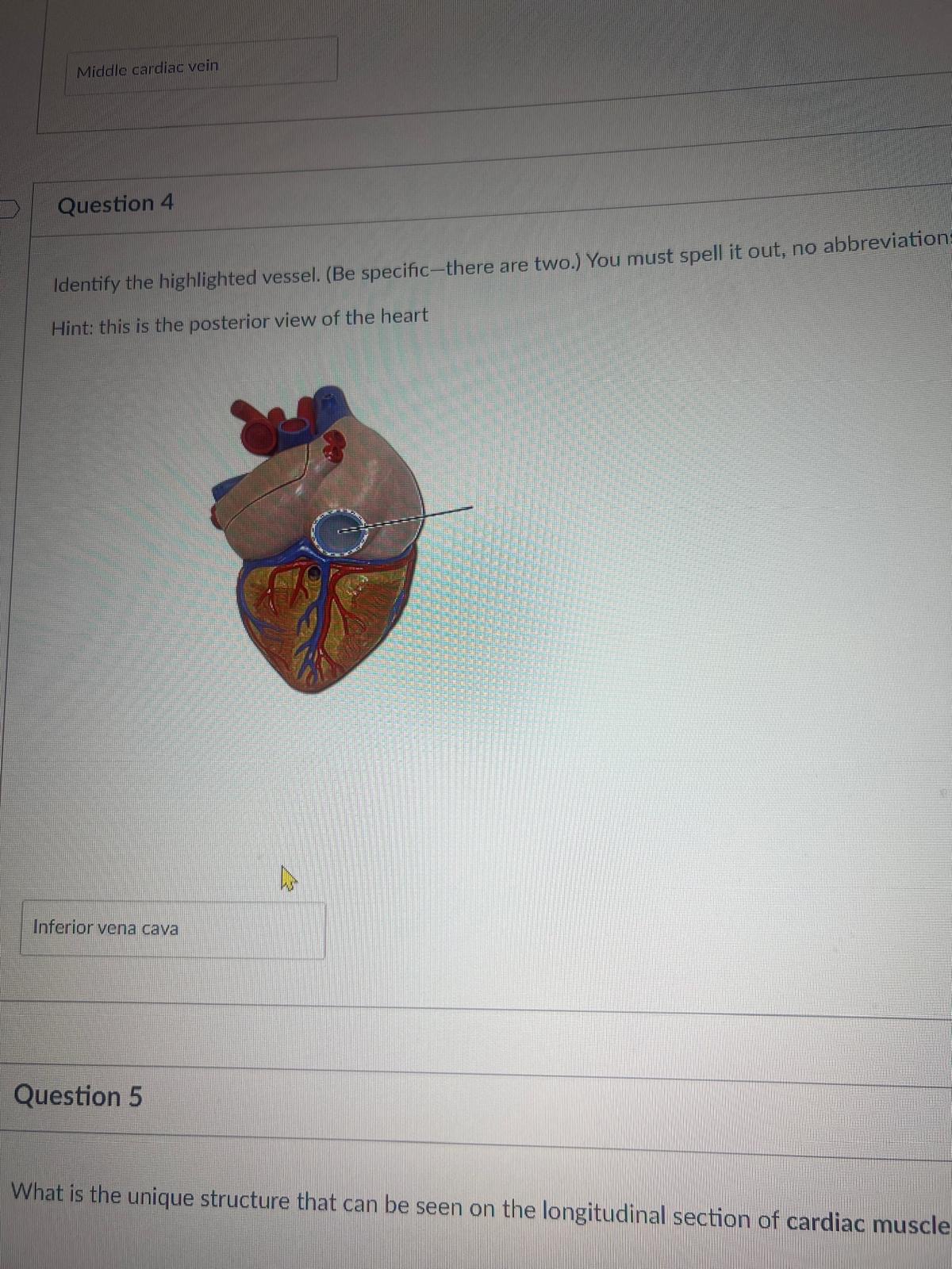 <p><span>Identify the highlighted vessel. (Be specific-there are two.) You must spell it out, no abbreviation. Hint: this is the posterior view of the heart</span></p>