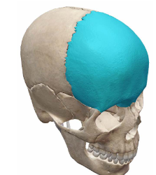<p>What Cranial bone is this?</p>