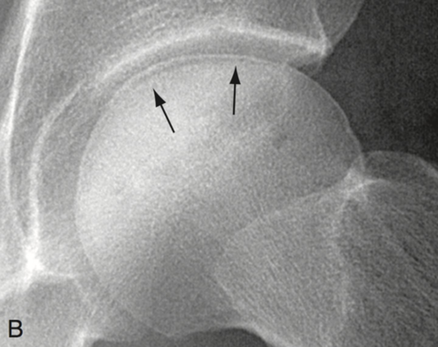 <p>What pathology is this?</p>