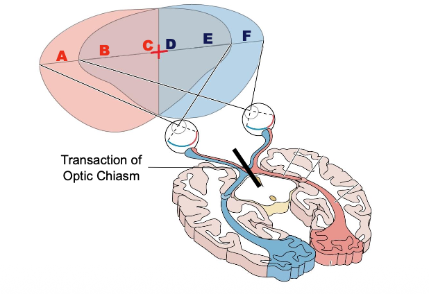 <p>Which letters can you read? </p>