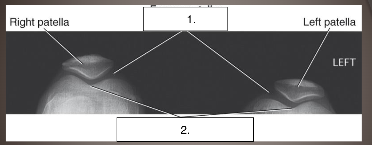 <p>Projection?</p><p>Label?</p>