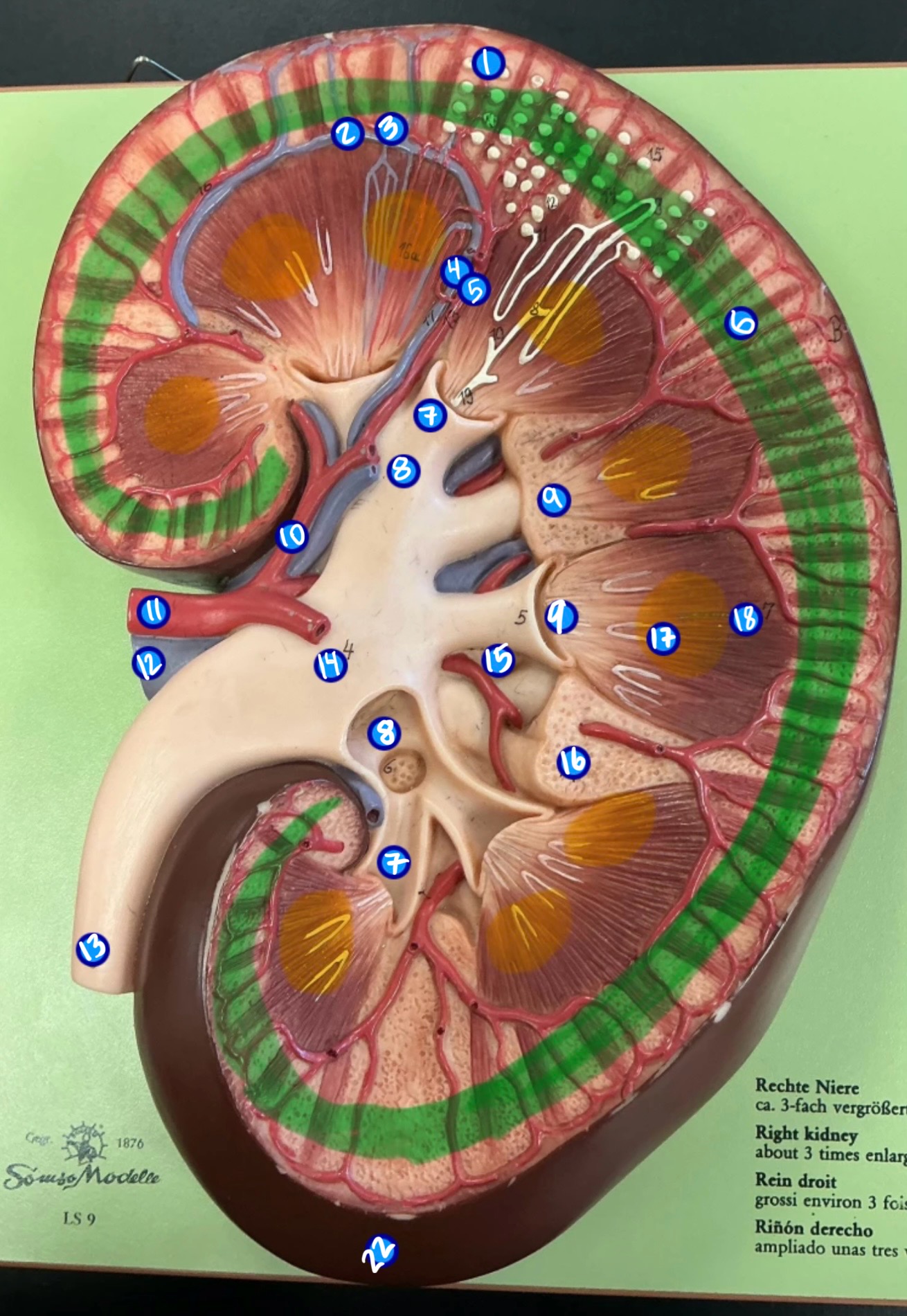 <p>ID structure #1</p>