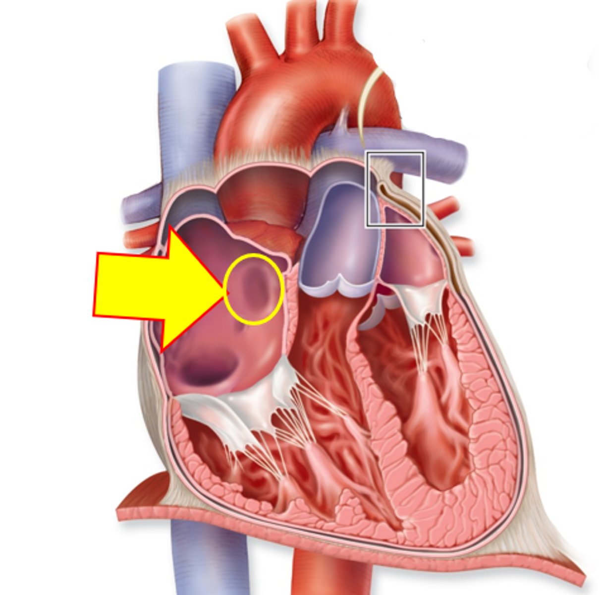 <p>Name this structure in an adult heart.</p>