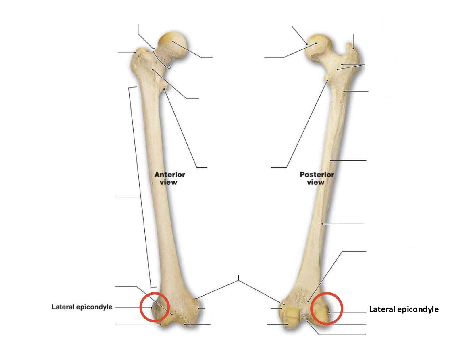 <p><span><span>Lateral </span></span><span>epicondyle</span></p>