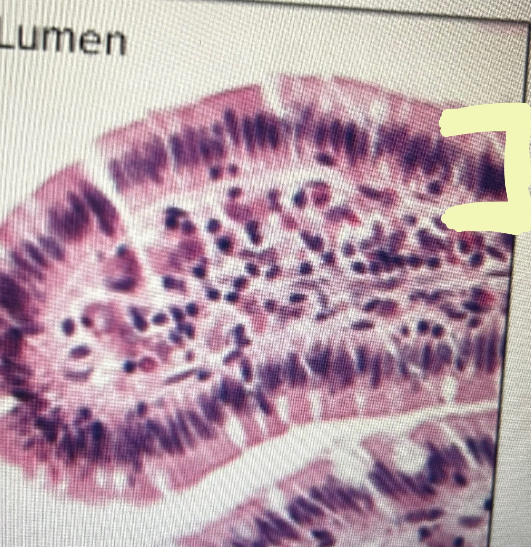<p>what type of layer is this?</p>