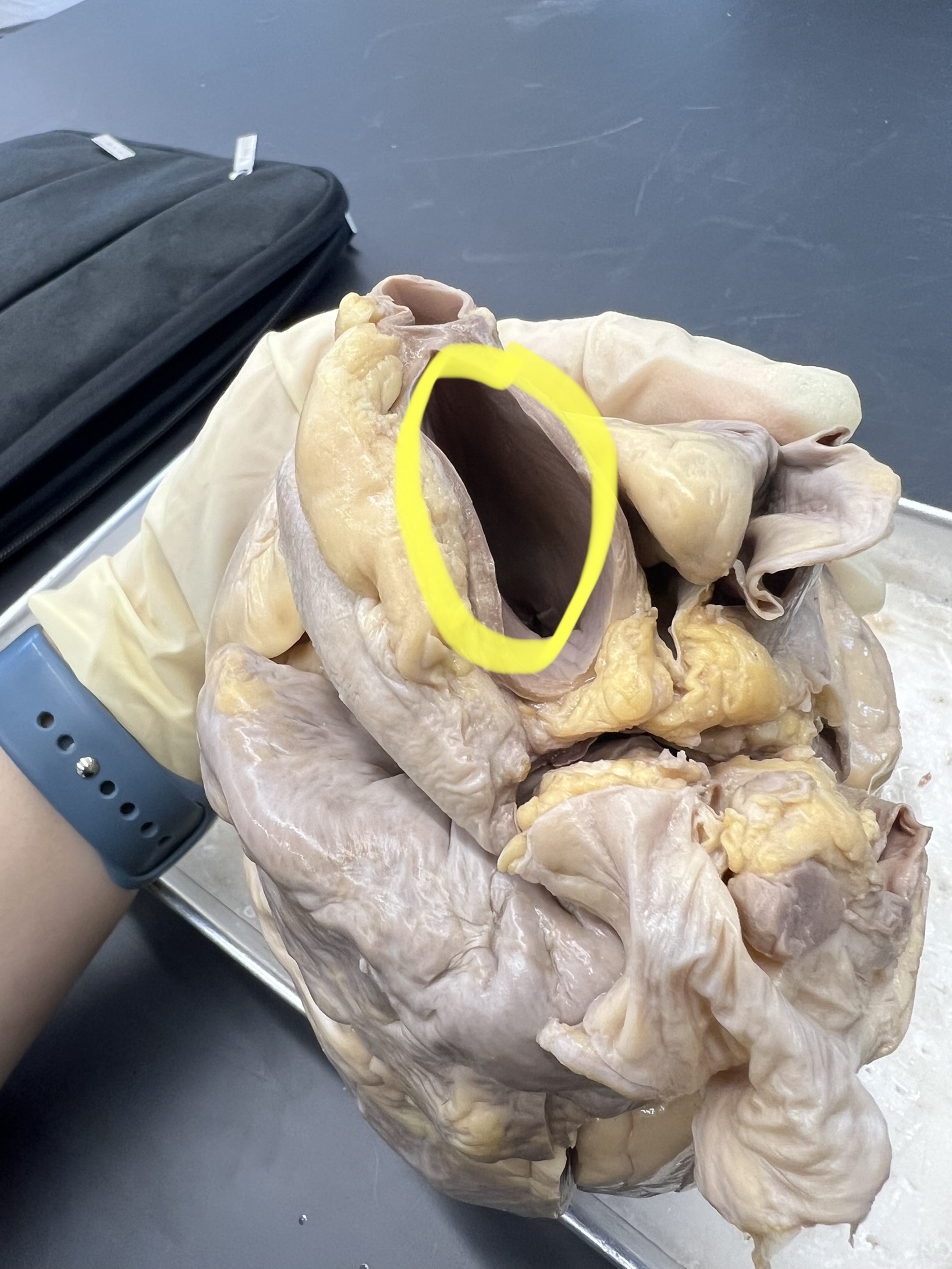 Name the heart structure.