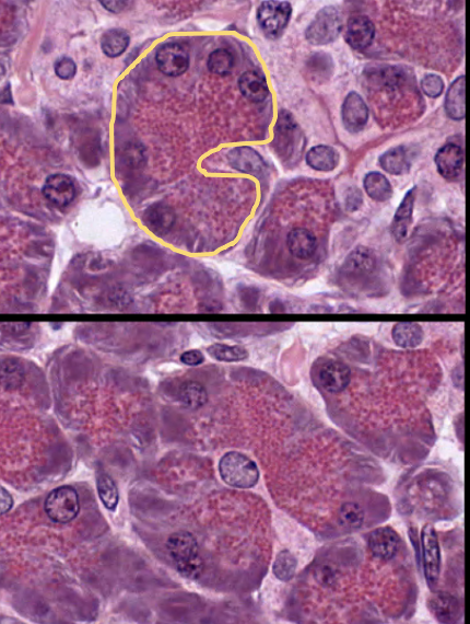 <p>This is a section of the pancreas. ID the gland by the product secreted. Glandular cells are outlined.</p>