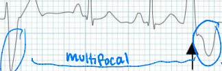 <p>Are these unifocal or multifocal?</p>