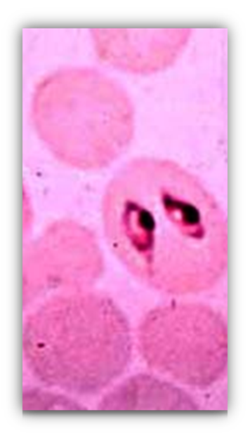 <p>Host: bovines Intermediate host: Boophilus annulatus (blue cattle tick) Locations: within the RBC&apos;s Transmission: bite of an infective intermediate host Clinical signs: fever, depression, icterus, anorexia, hemoglobinuria, pale mucus membranes, weakness, splenomegaly Diagnosis: stained blood smear Treatment: dip for ticks, Dimiazene aceturate (Berenil), Phenamidine Common name: Babesia</p>