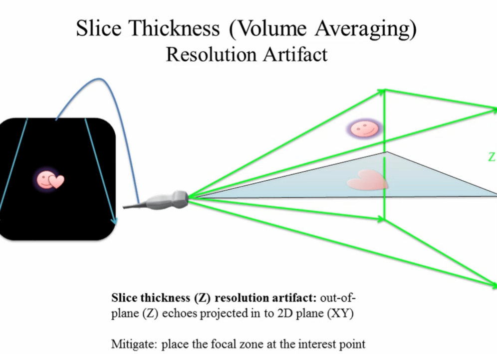 <p>Low level scattered echoes filling in an anechoic area.</p>