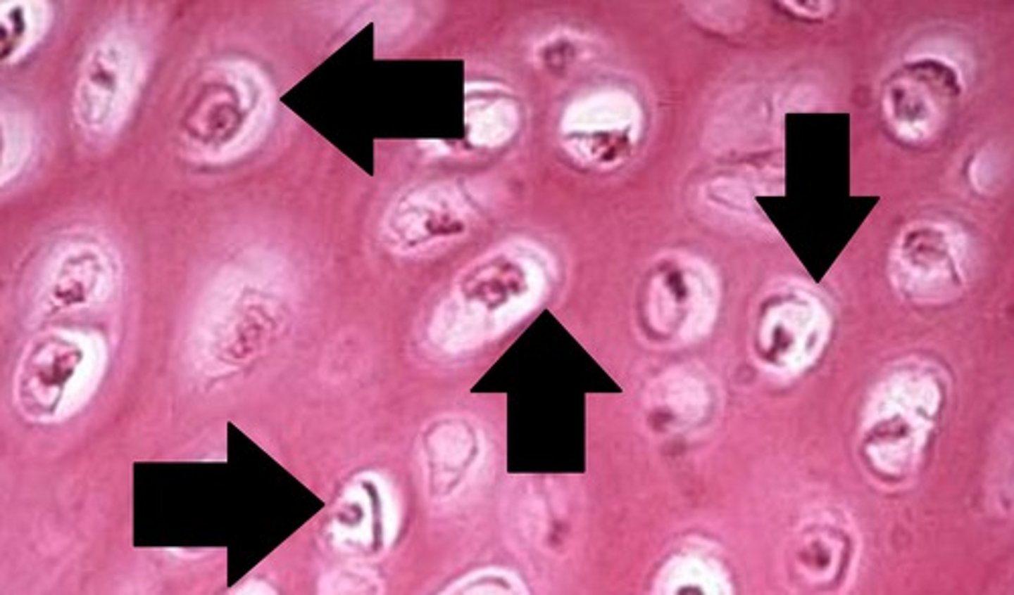 <p>small cavities in bone that contain osteocytes</p>