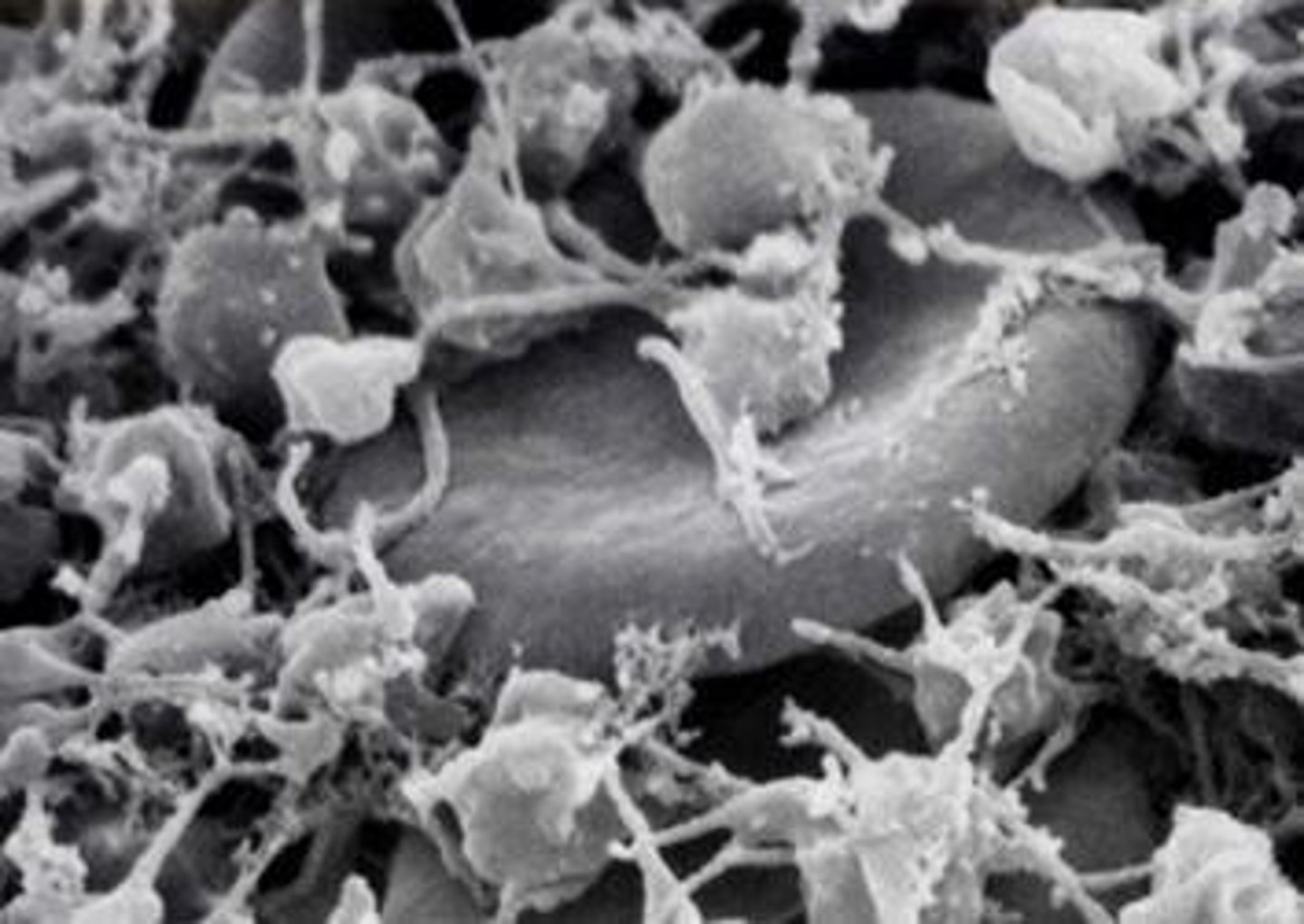 <p>Fragments of cells that function in blood clotting</p>