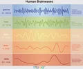 <p>EEG, measures the brain&apos;s electrical activity</p>