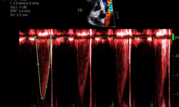 <p>what measurement is this</p>