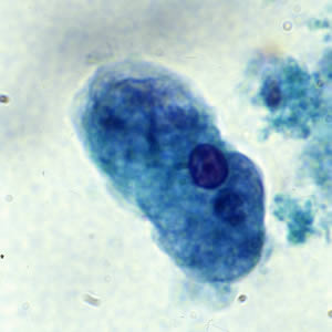 <p>single nucleus with centrally placed karyosome. Cytoplasm contains ingested RBC’s.</p>