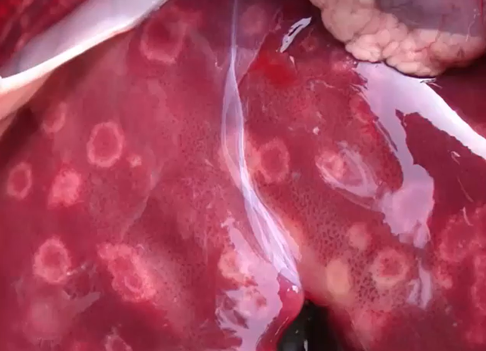 <p>Lamb. MDX and 2 possible causes. </p>
