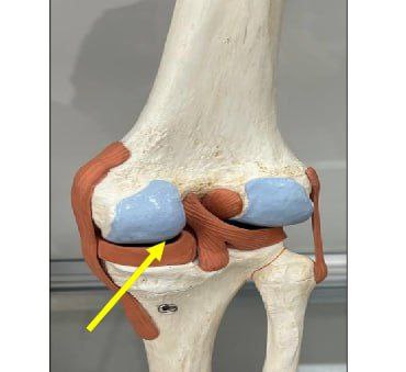 <p>Identify the joints in this picture and classify them </p>
