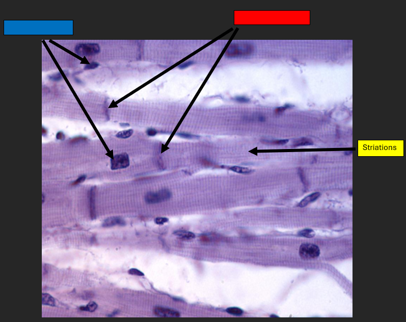 <p>Striations</p>