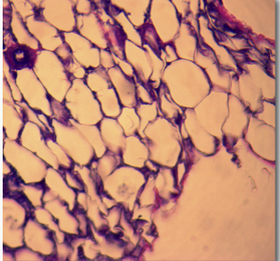 <p>surrounds most organs and joints; significant amounts beneath the dermis of the skin; major portion of female breasts</p>