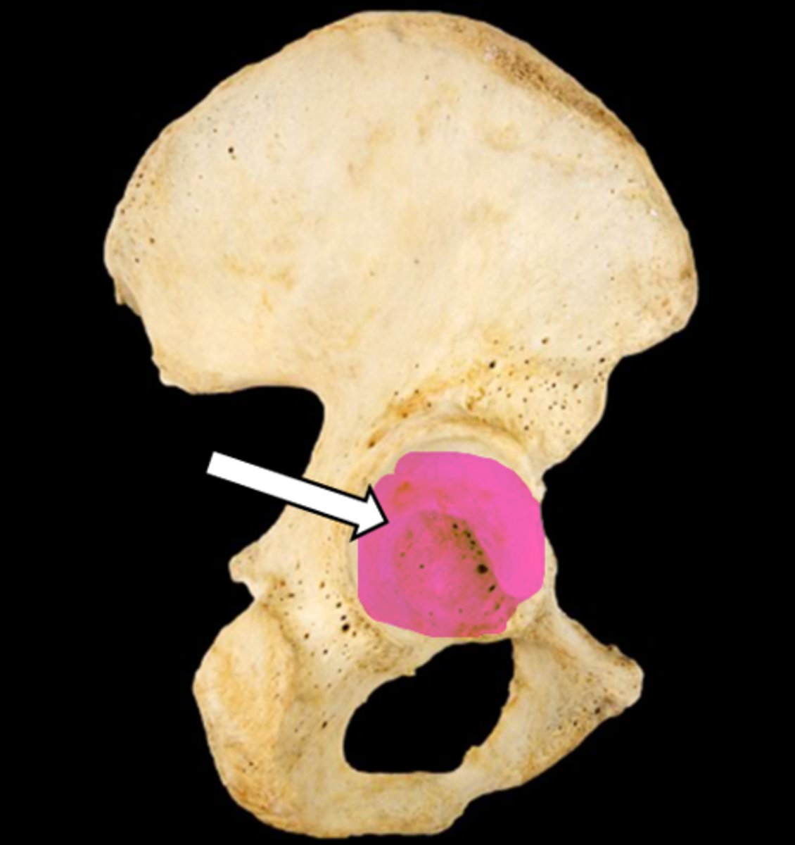 <p>name the part</p>