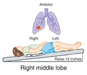 <p>What CPT position is pictured, and when is it used?</p>