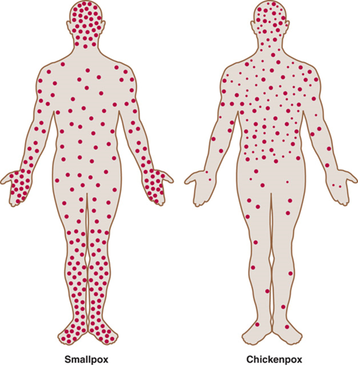 <p>Centrifugal, clusters on extremities</p>