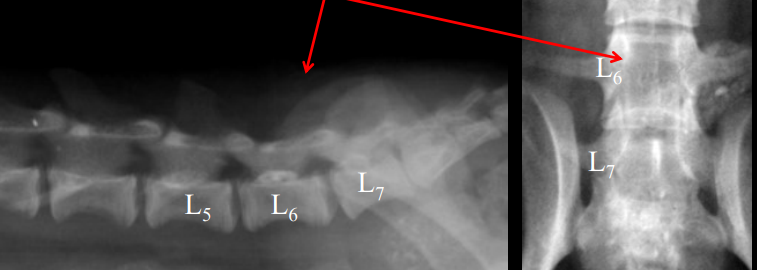 <ul><li><p><strong>Cause</strong></p><ul><li><p><strong>Congenital malformation and failure of fusion of dorsal arches</strong></p></li><li><p>Bostons, bulldogs, Pug, Manx</p><ul><li><p>screw tails</p></li></ul></li><li><p><strong>failure of fusion</strong> of dorsal lamina on dorsal arches and spinous processes</p></li></ul></li><li><p><strong>CS</strong></p><ul><li><p><strong><u>Young: clinical</u></strong></p></li><li><p><strong><u>Old: non-clinical</u></strong></p></li></ul></li><li><p><strong>Views</strong></p><ul><li><p>Lateral and VD</p></li></ul></li><li><p><strong>RS</strong></p><ul><li><p>2 paired dorsal spinous processes, missing/blunted L7 dorsal spinous, distended colon or bladder</p></li><li><p><strong>SB occulta=</strong> bony defect</p></li><li><p><strong>SB manifesta= </strong>meninges and spinal cord <strong>herniated</strong> through bony defect</p></li></ul></li></ul><p></p>