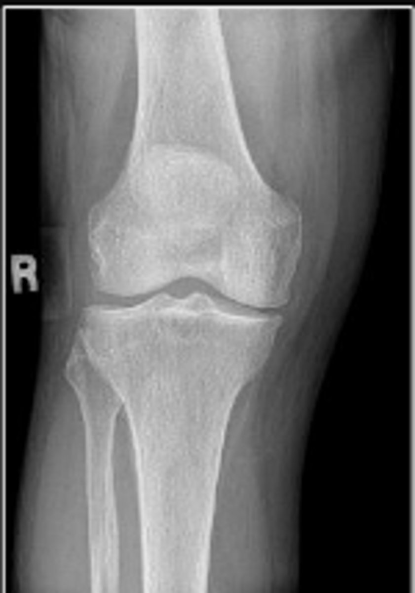 <p>What is the name of the radiographic view?</p>