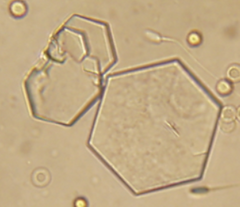 <p>What type of acid urine crystal is this?</p>