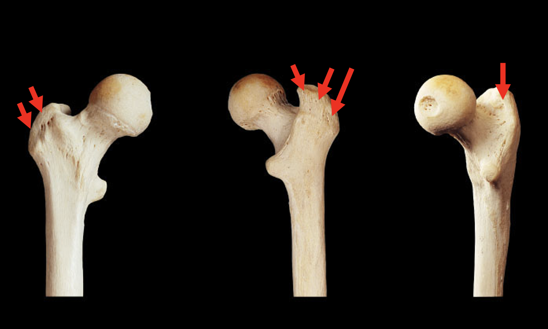 <p>Name this region of the femur</p>