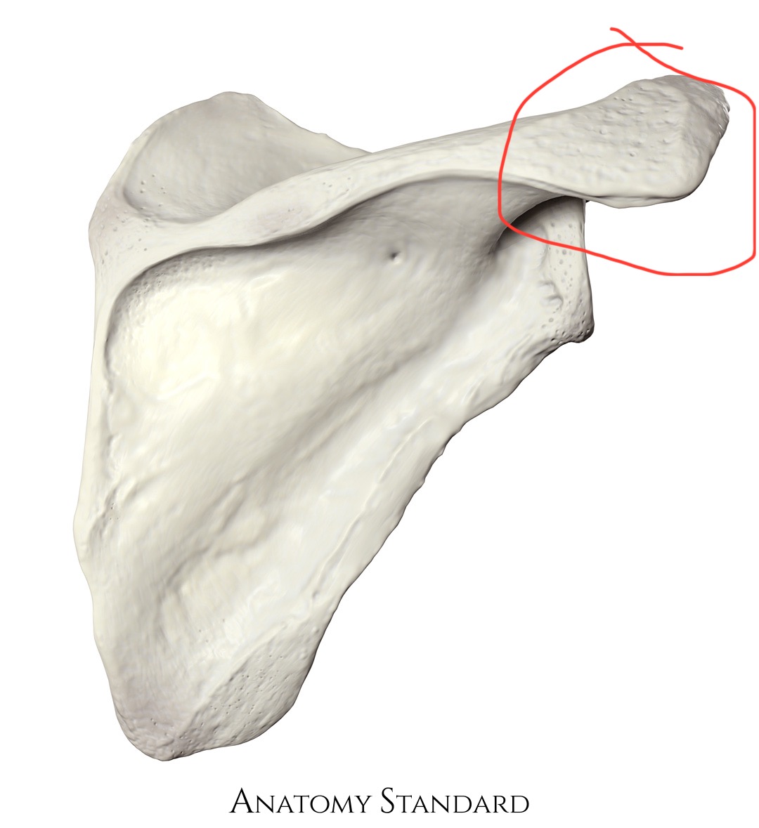 <p>scapula, juts out towards shoulder</p>