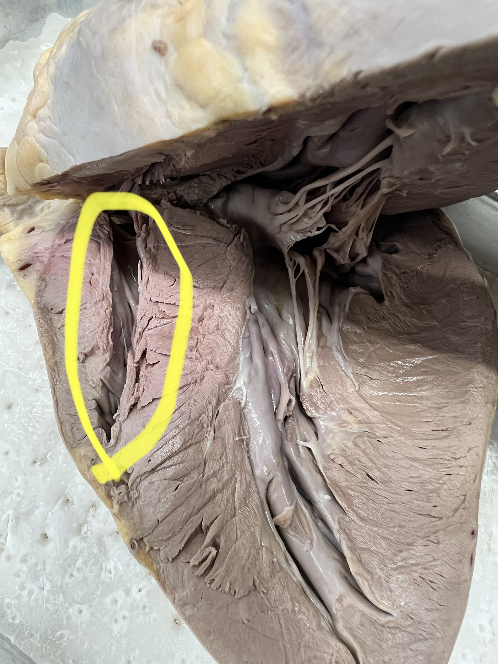 Name the heart structure.