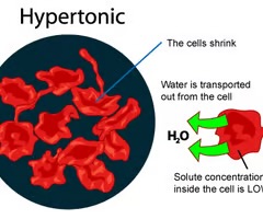 <p>hypertonic solution</p>