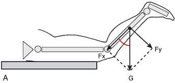 <p>Gravity on knee joint at 45 degrees, gravity’s parallel force pushes lower leg bones toward femur</p>