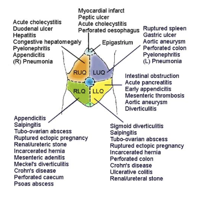 <p>4 Quadrant Division (More Commonly Used)</p>