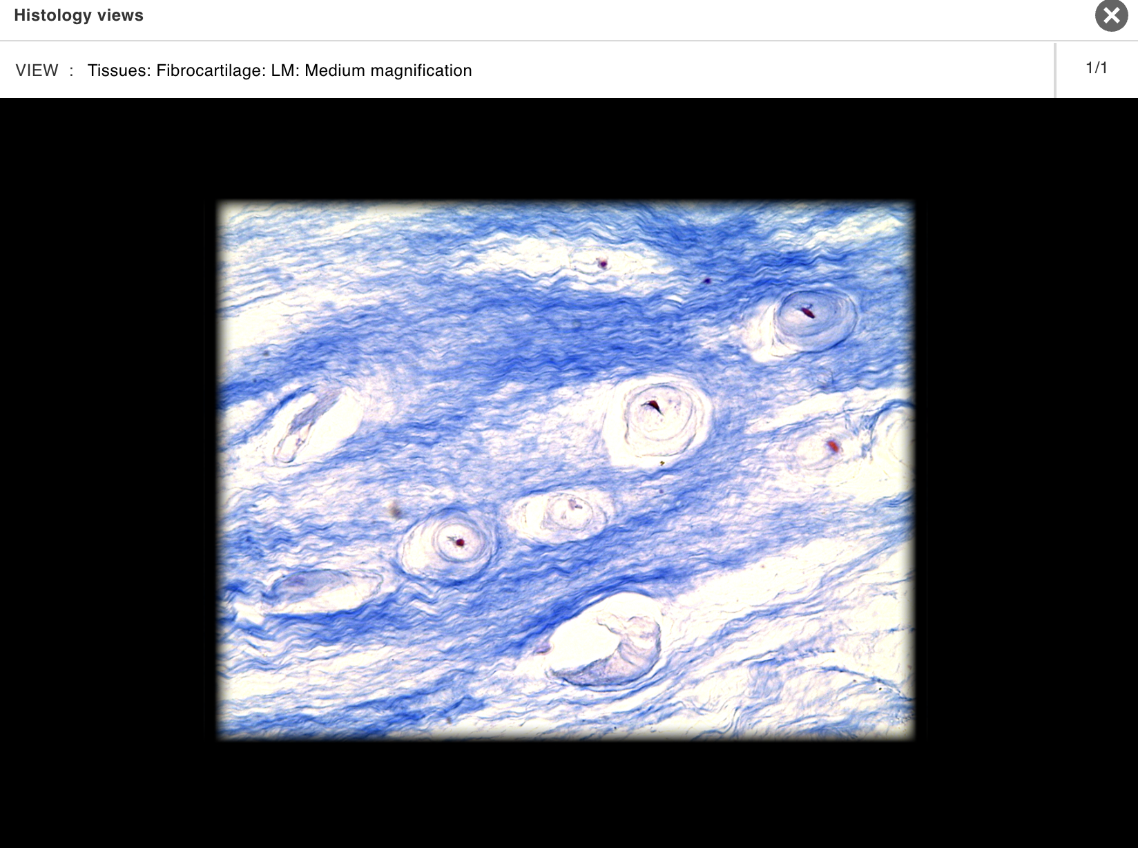 <p>Intervertebral disc</p>