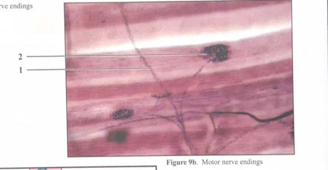 <ol><li><p>Nerve fiber </p></li><li><p>Neuromuscular junction </p></li></ol><p></p>
