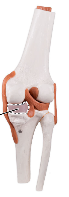 <p>What is the highlighted fibrocartilage?</p>