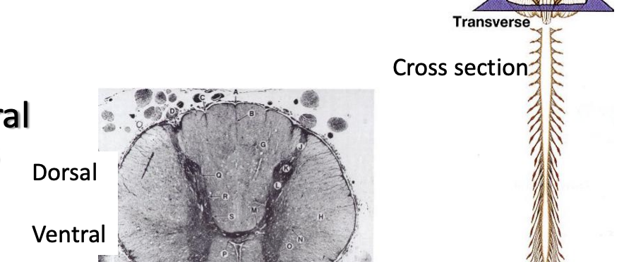 <p>cuts spinal cord and brainstem into rostal and caudal sections </p>