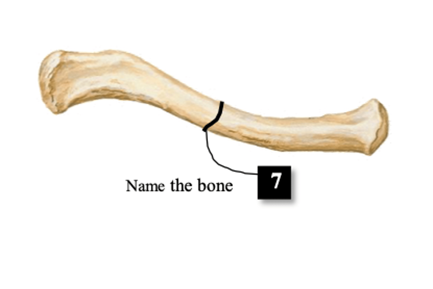 <p>#7</p>